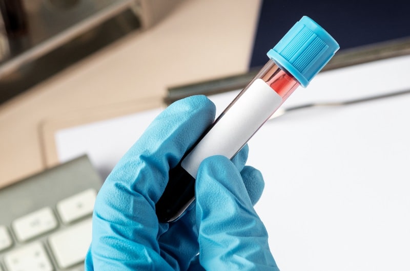 Junho vermelho: a importância da conscientização da doação de sangue